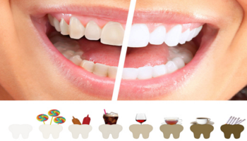 Léteznek olyan élelmiszerek melyek összetétele elszínezi a fogakat, ill. foltokat okoz. 