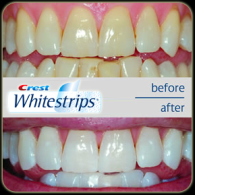 A Crest fehérítő matricák hasonló összetevőket tartalmaznak mint amelyeket a fogorvosok használnak a professzionális fogfehérítésnél. 
